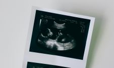 ultrasound picture of unborn baby on white background